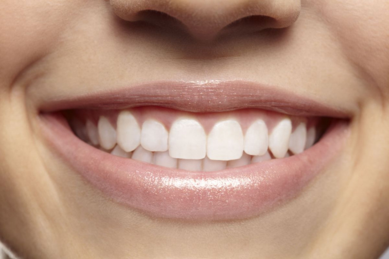 Mulher jovem com dentes brancos