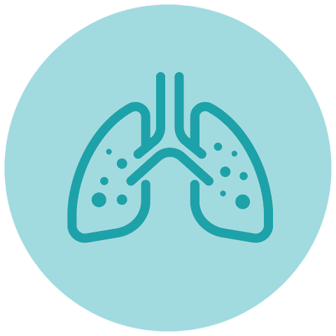 cauzele cancerului pulmonar - expunerea la azbest