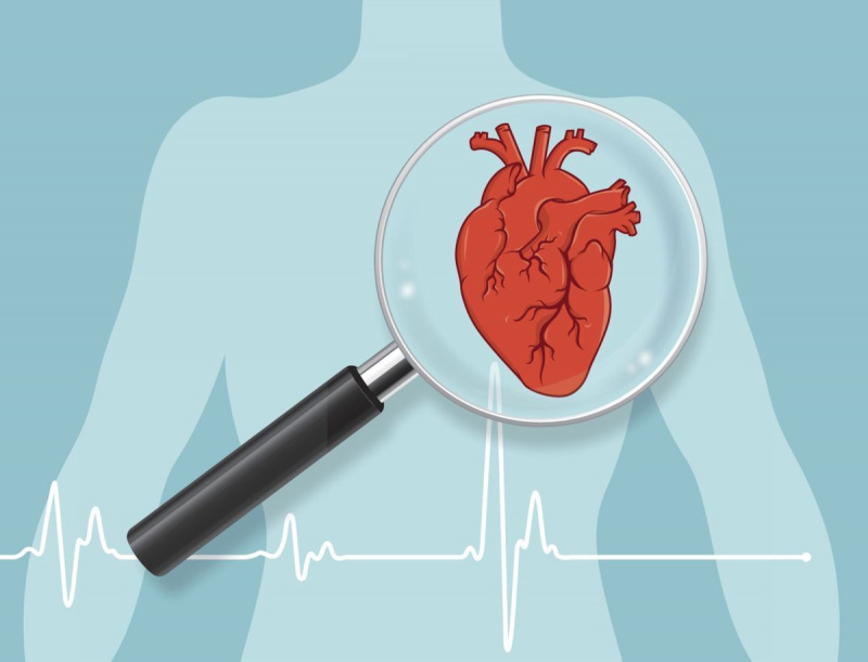 parada cardíaca vs ataque cardíaco