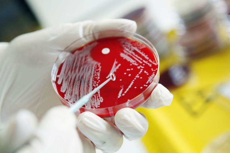 Vad är melioidos, den sällsynta bakteriella infektionen som CDC varnar för?
