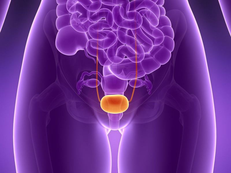 女性の膀胱がんの症状